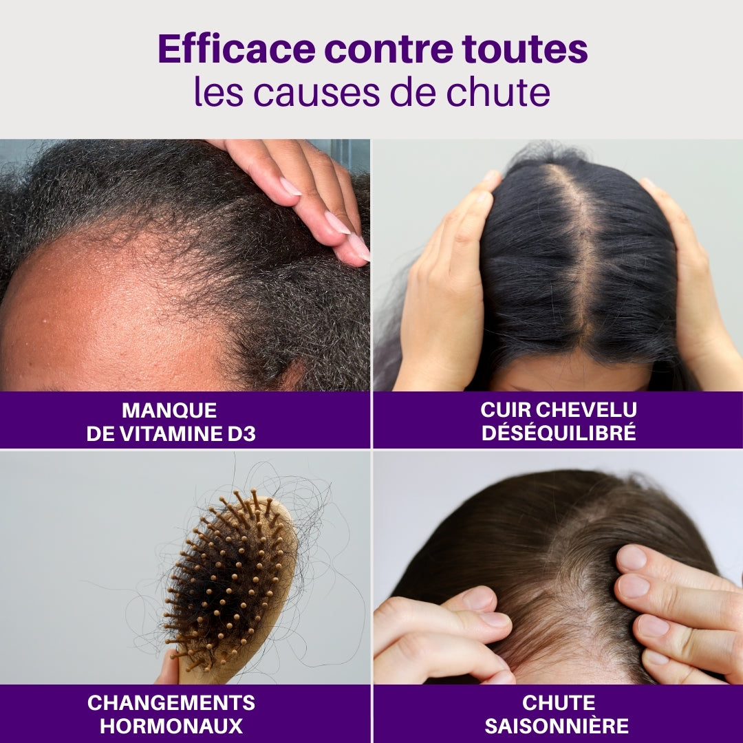 Gummies Pousse de cheveux à la vitamine D3